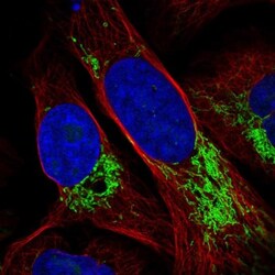 DDX49 Antibody, Novus Biologicals 25 &mu;L; Unlabeled:Antibodies, Polyclonal